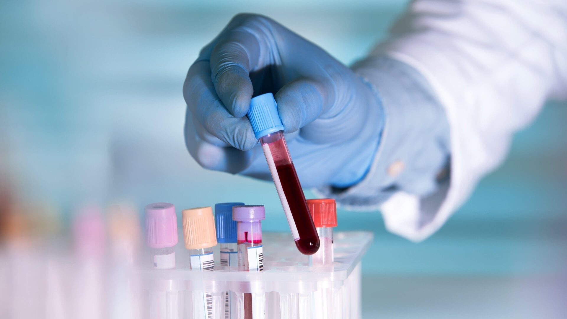 英矽智能AI药物Rentosertib：42人12周试验中，六种衰老时钟测得生物年龄下降